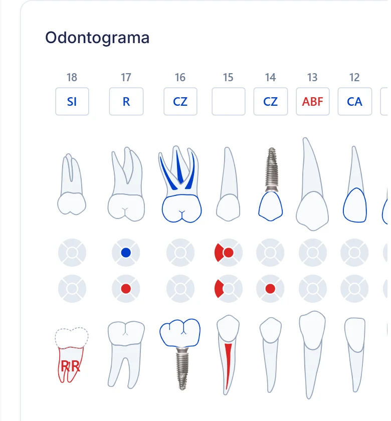 Odontograma de Dentista360 con implantes, endodoncias, coronas, un puente y caries marcados según la norma del odontograma del CCDP